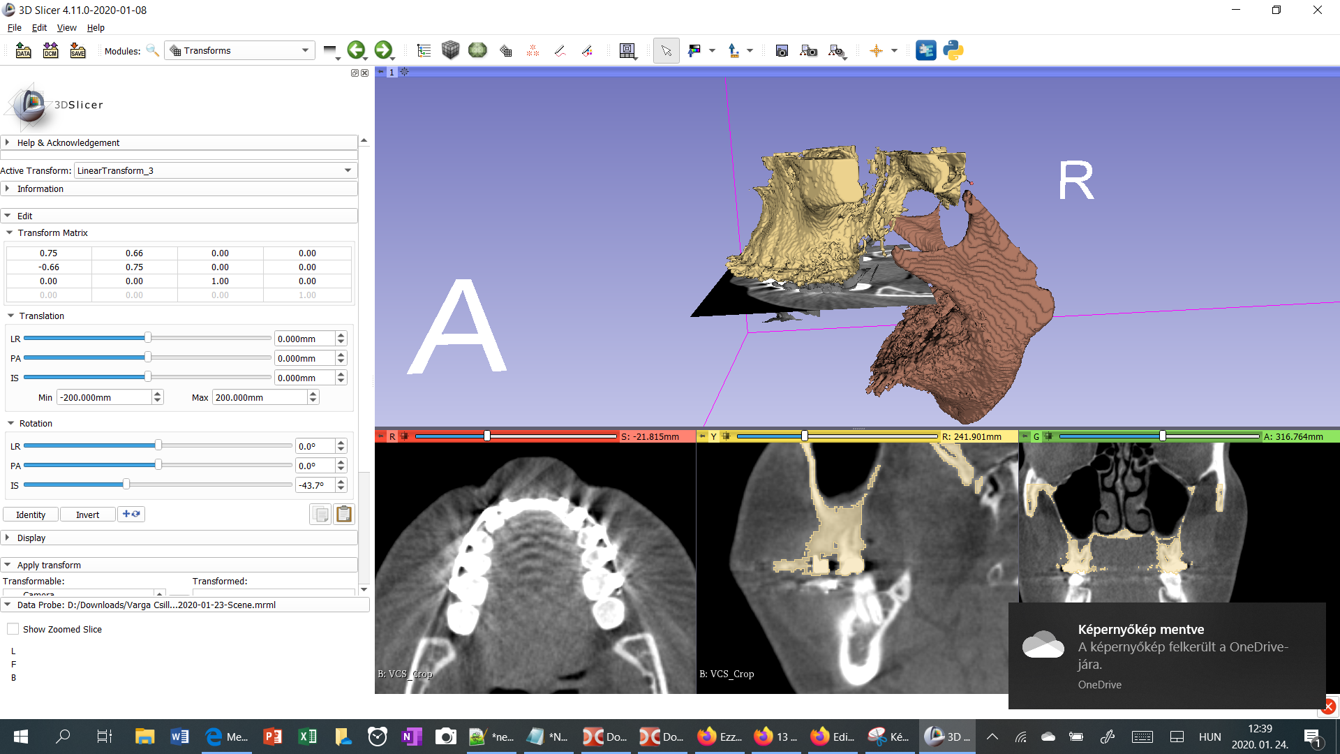 Slicer showing the rotation of a segment around a defined axis, moved with a mouse